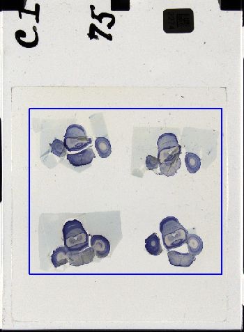Media type: image; Special Collections 3298   shows specimen_part histological serial section;